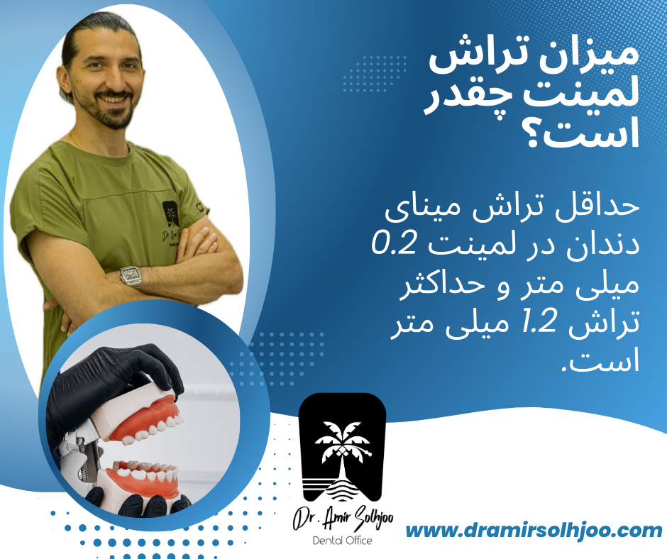 میزان تراش لمینت دندان چقدر است؟