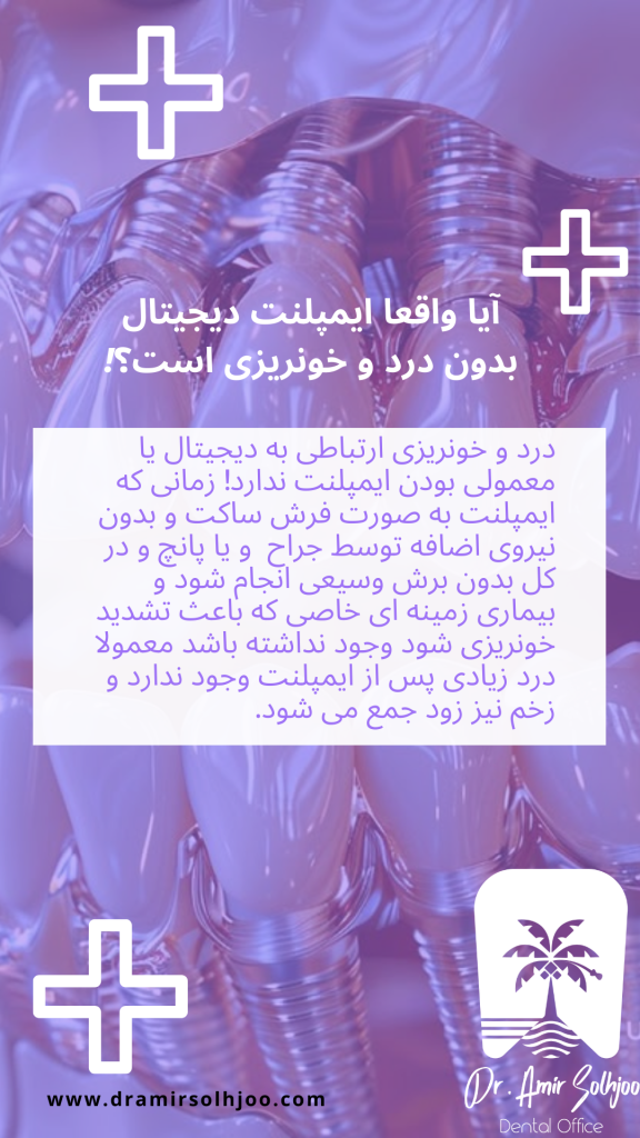 ایمپلنت دیجیتال بدون درد