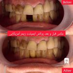 بهترین مرکز ایمپلنت تهران
