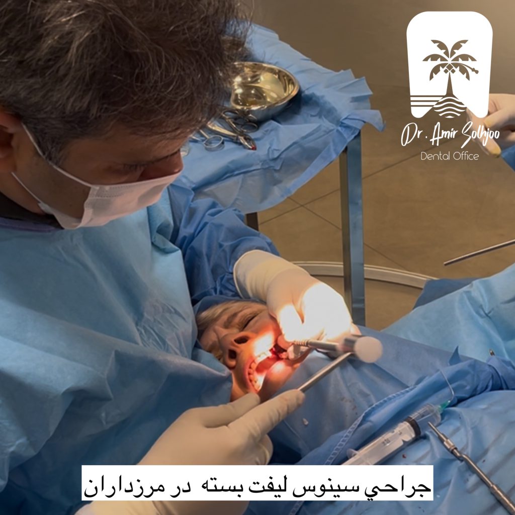 بهترین فوق تخصص ایمپلنت