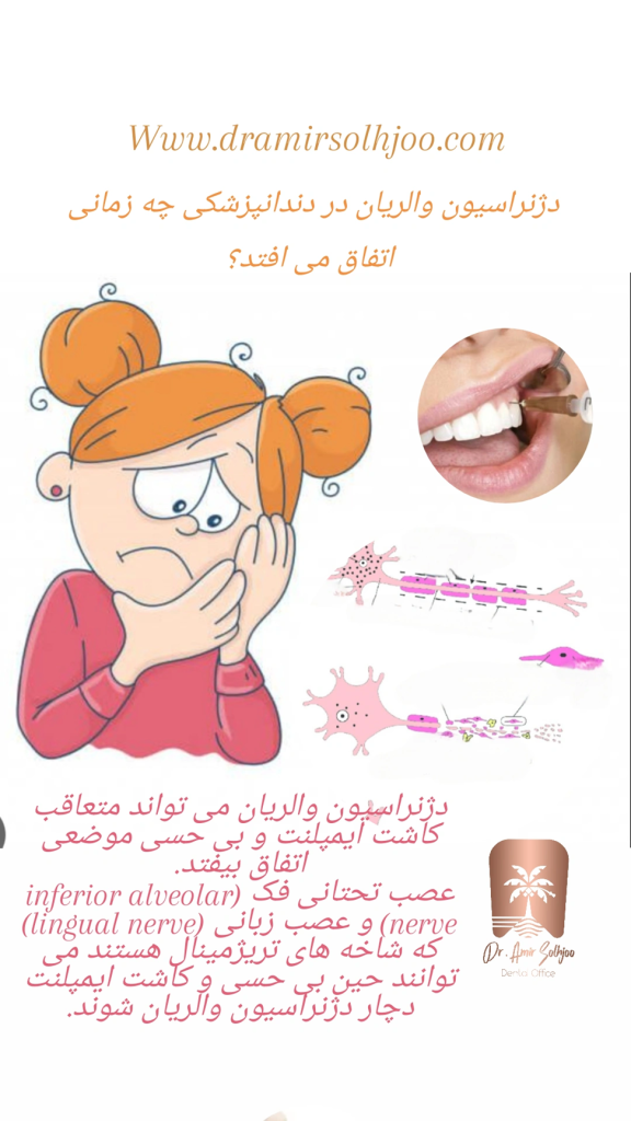 عصب تحتانی فک
