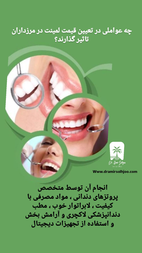 قیمت لمینت در مرزداران