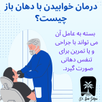 درمان خوابیدن با دهان باز