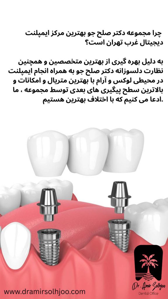 بهترین مرکز ایمپلنت دیجیتال مرزداران