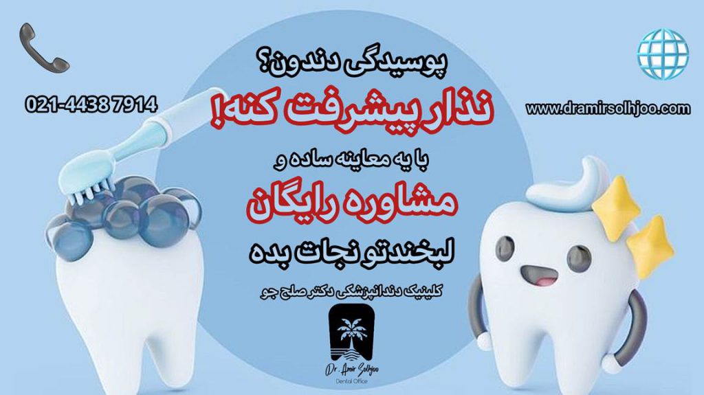 ویزیت رایگان پوسیدگی دندان