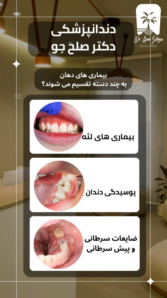 بیماریهای دهان و دندان