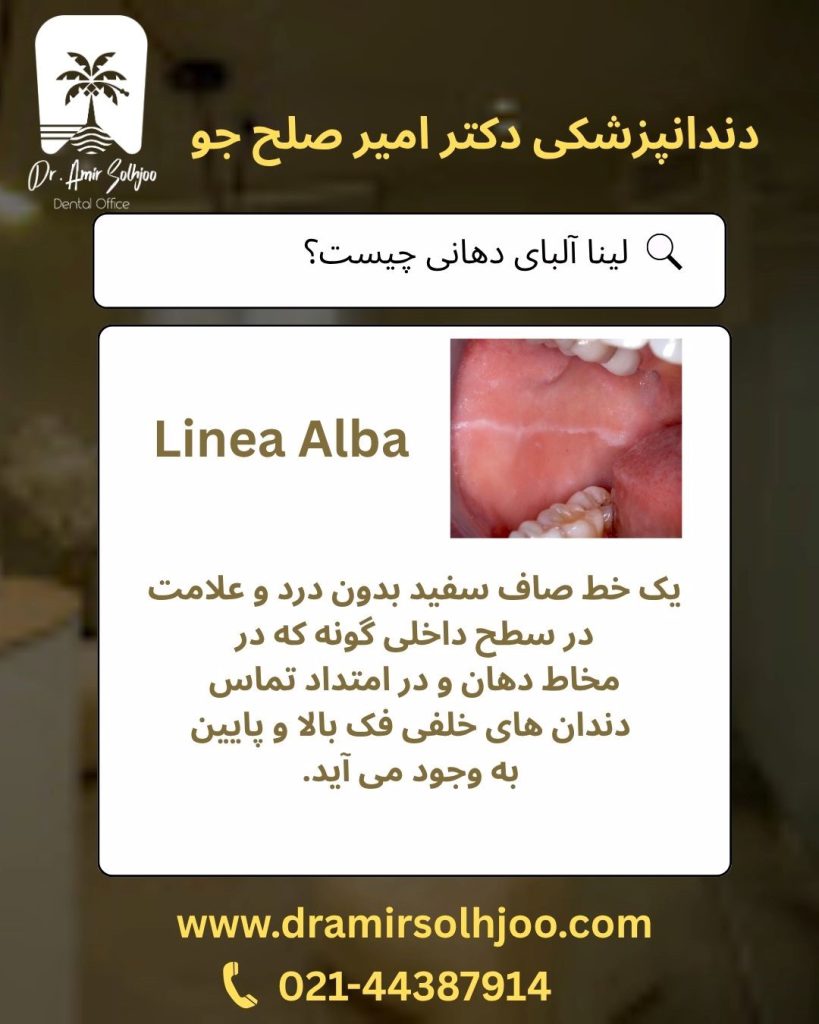 لینا آلبا