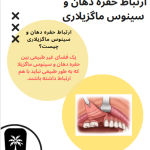 ارتباط حفره دهان و سینوس ماگزیلاری