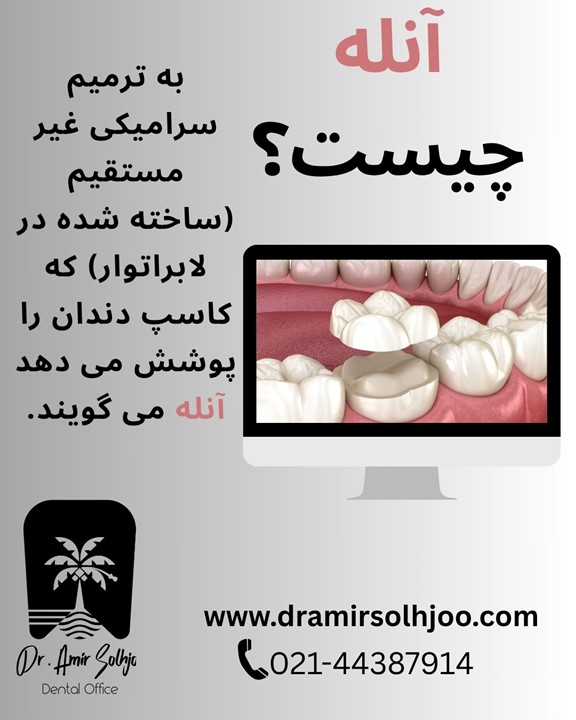 آنله چیست