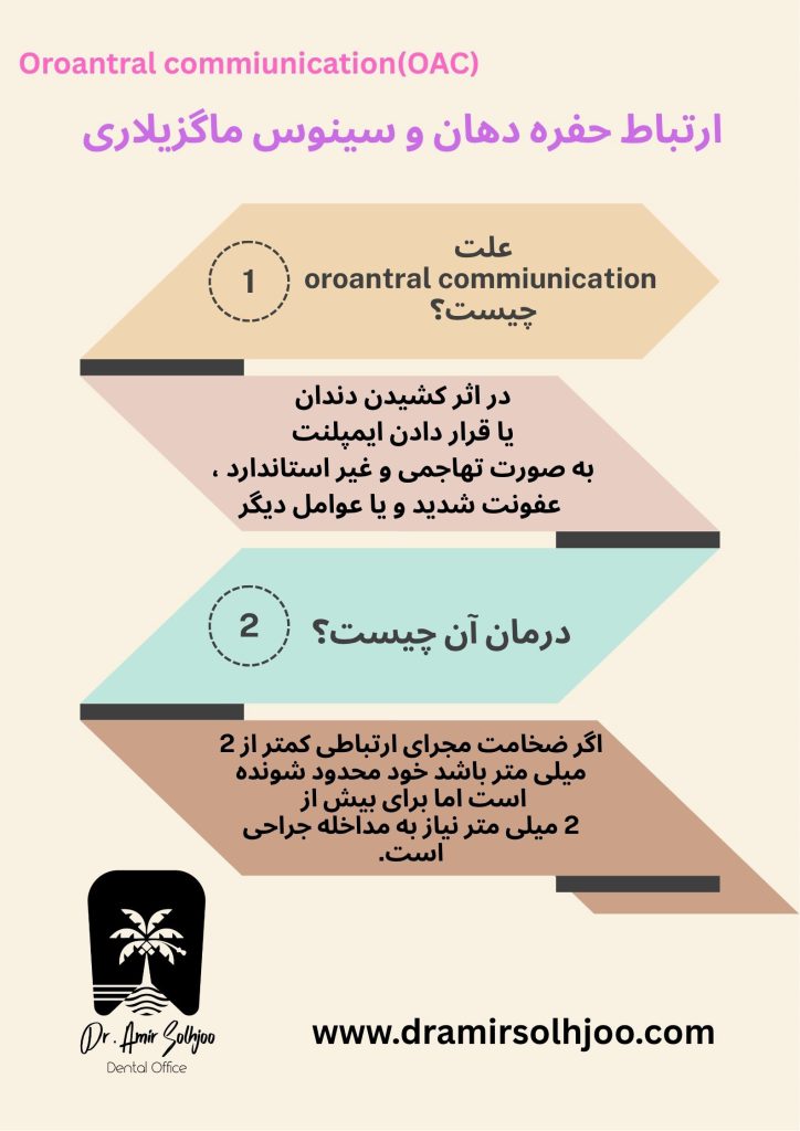 علت ارتباط حفره دهان و سینوس ماگزیلاری
