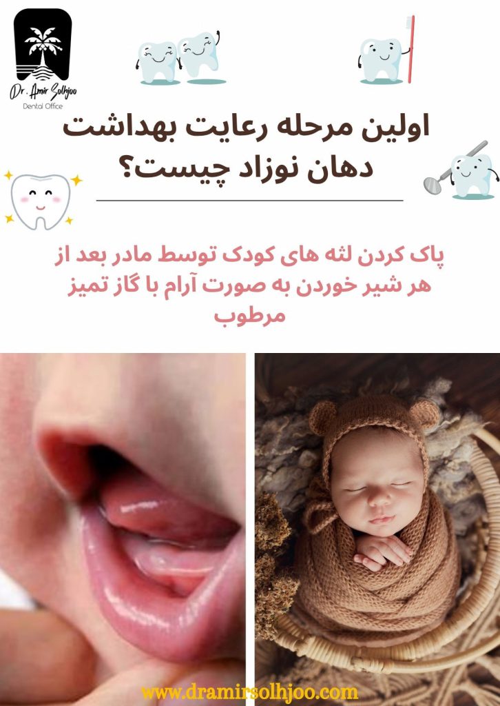رعایت بهداشت دهان نوزاد