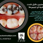 نشت حاشیه ای ترمیم ها