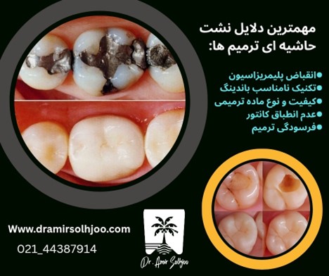 علت نشیت حاشیه ای ترمیم ها