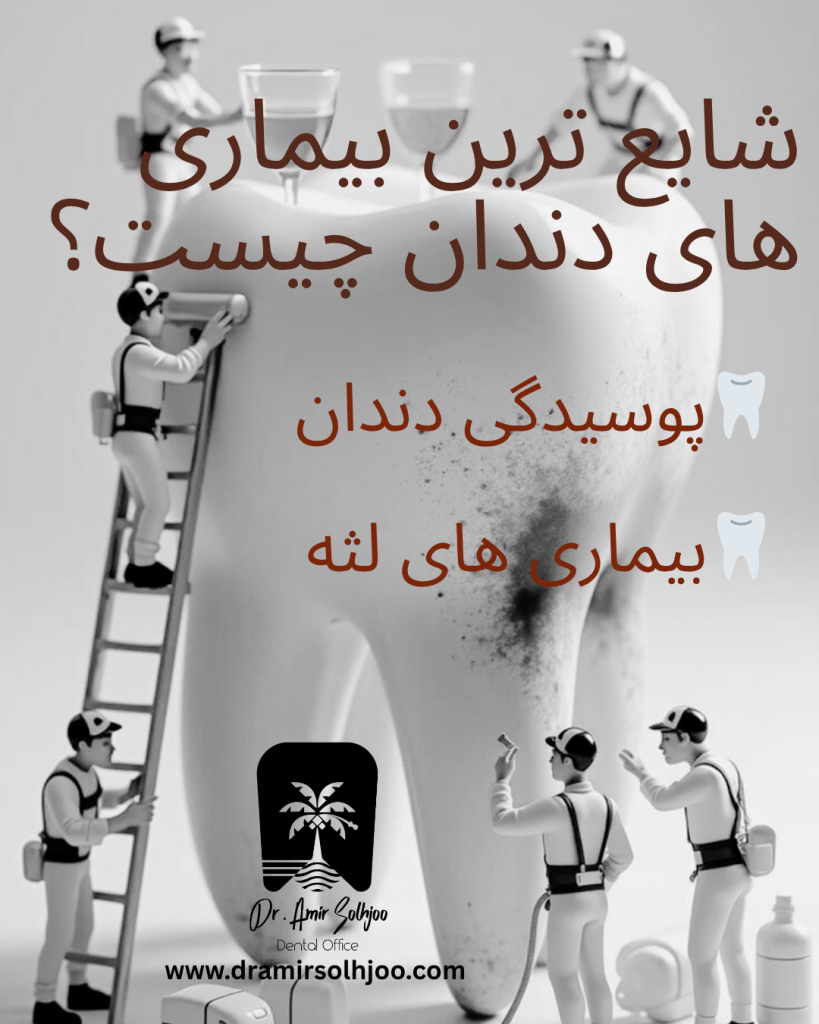 شایع ترین بیماریهای دهان و دندان
