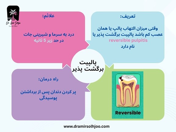 پالپیت برگشت پذیر