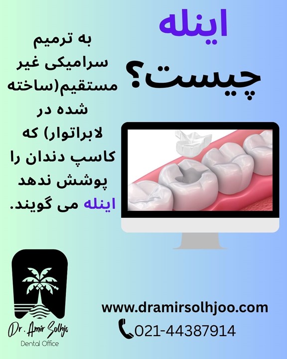 اینله چیست