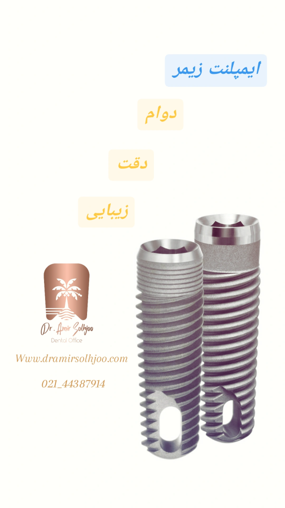 خرید ایمپلنت زیمر در تهران