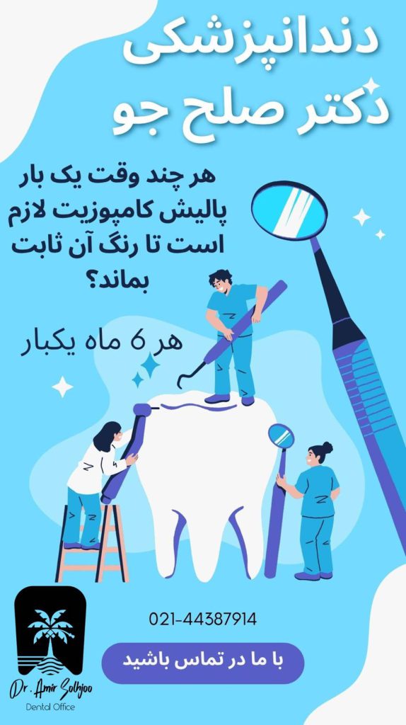 پالیش کامپوزیت دندان
