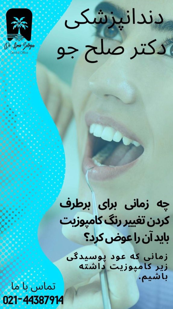 درمان تغییر رنگ کامپویت