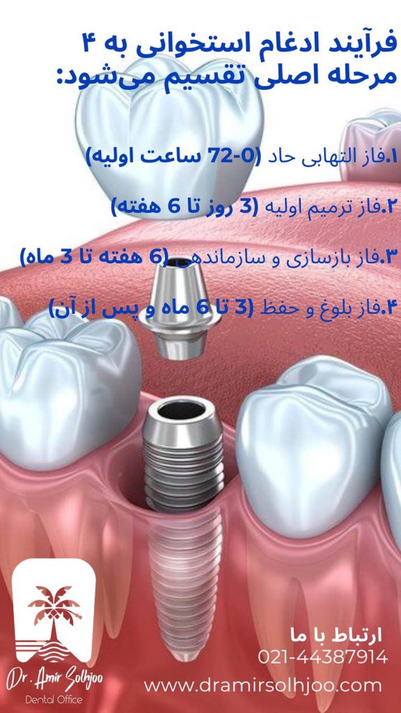 ادغام استخوانی