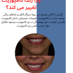 تغییر رنگ کامپوزیت
