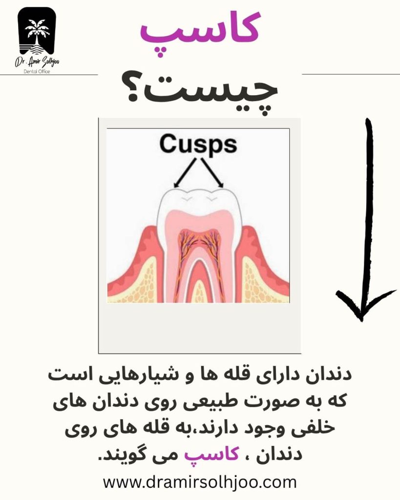کاسپ (cusps) دندان چیست؟