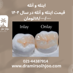 اینله و آنله در مرزداران