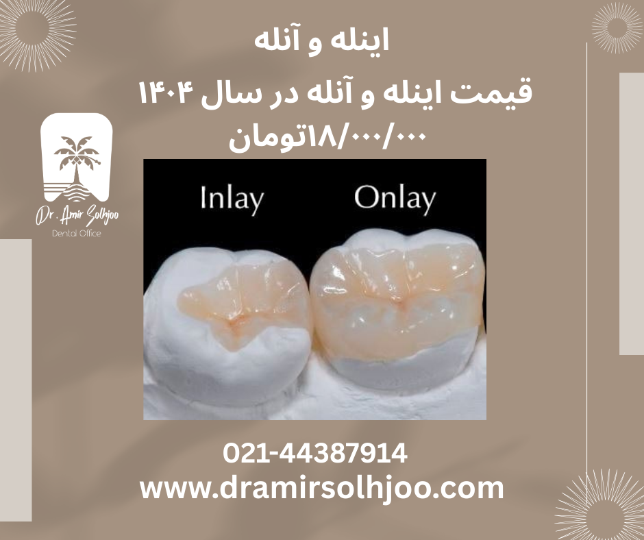 اینله و آنله در مرزداران