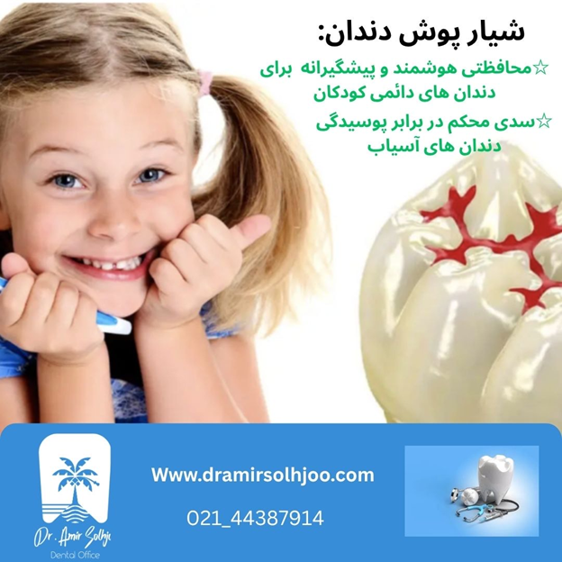فیشور سیلانت دندان کودکان