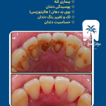 قیمت جرمگیری دندان