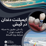 ایمپلنت دندان در کیش