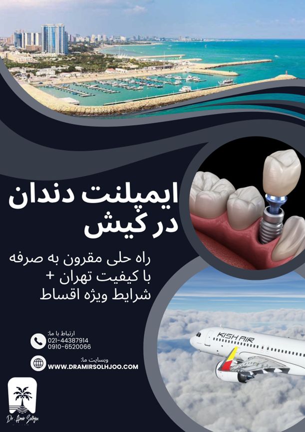 ایمپلنت دندان در کیش