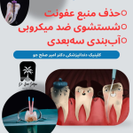 آموکسی سیلین بعد از عصب کشی