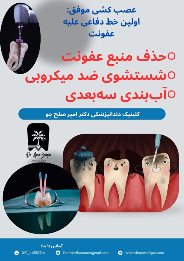آموکسی سیلین بعد از عصب کشی