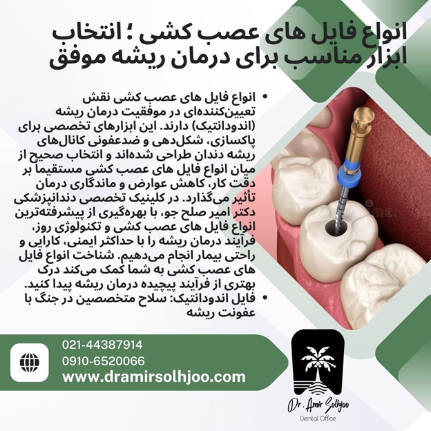 انواع فایل های عصب کشی دندان