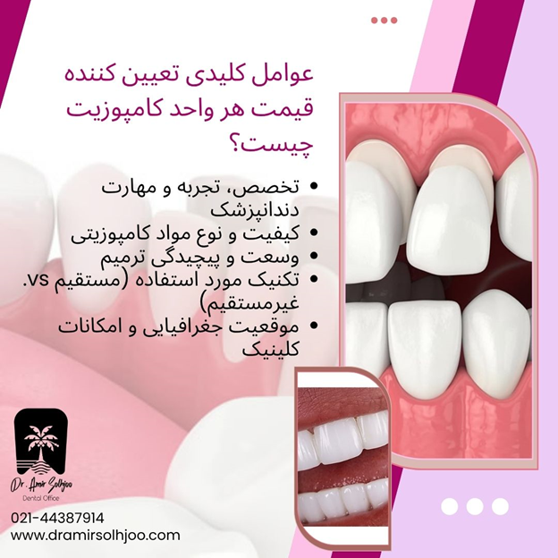 قیمت هر واحد کامپوزیت دندان