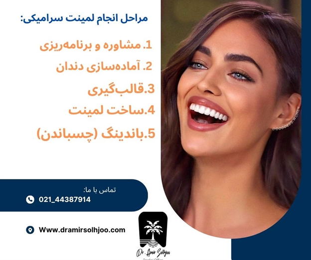 لمینت سرامیکی