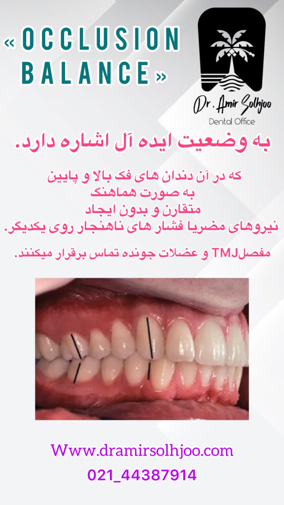 اکلوژن بالانس