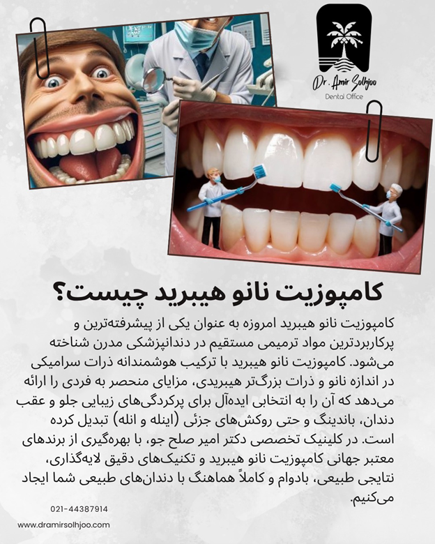 کامپوزیت نانو هیبرید