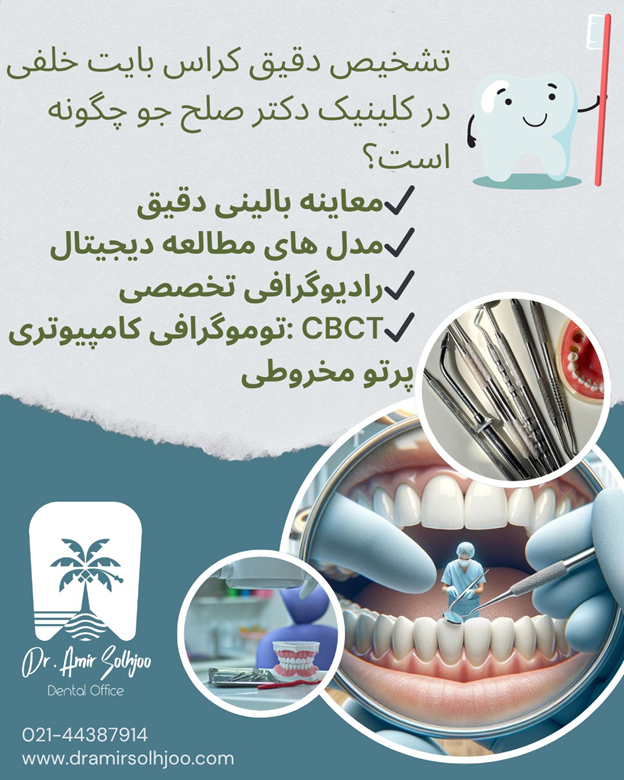 تشخیص کراس بایت خلفی