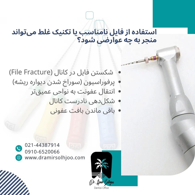 استفاده از فایل های عصب کشی در دندانپزشکی