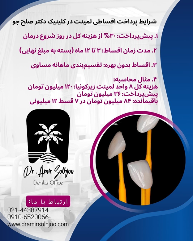 لمینت اقساطی غرب تهران
