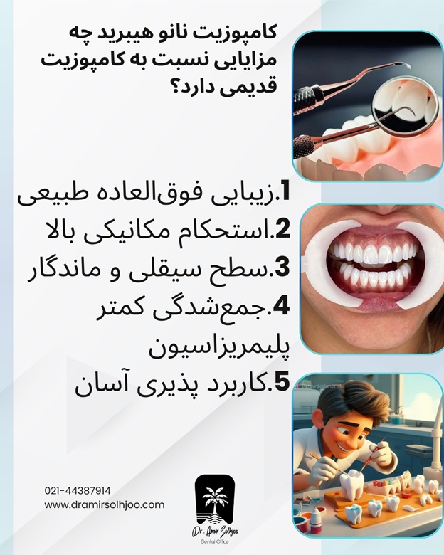 مزایای کامپوزیت نانو هیبرید