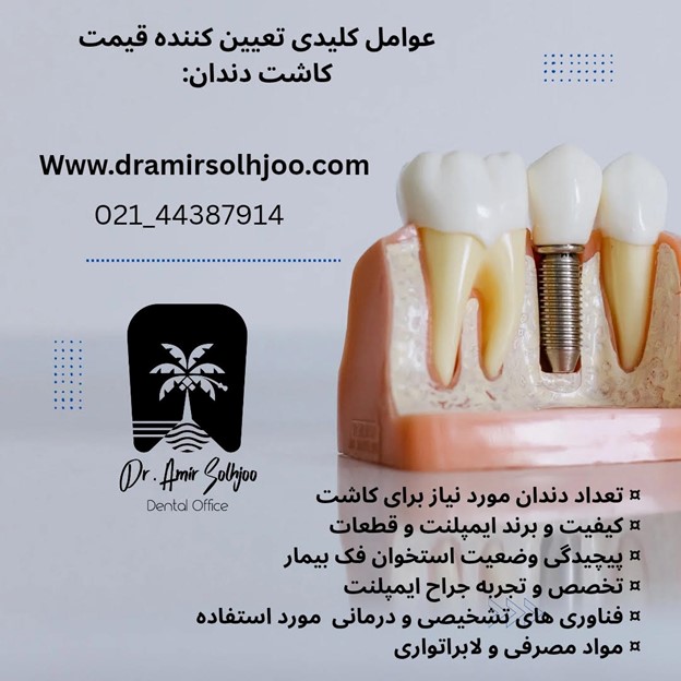 بهترین دکتر کاشت دندان در تهران