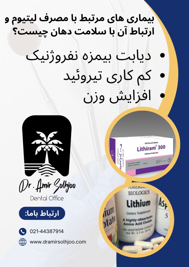 عوارض قرص لیتیوم بر دندان