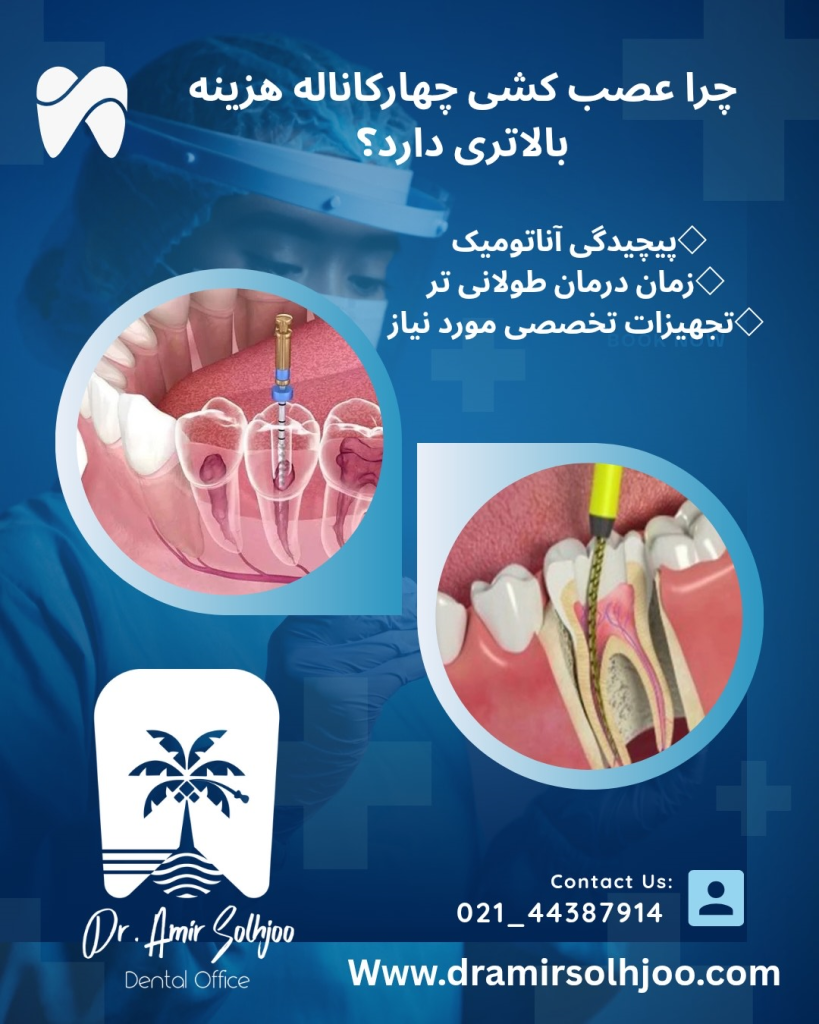 قیمت عصب کشی چهار کاناله