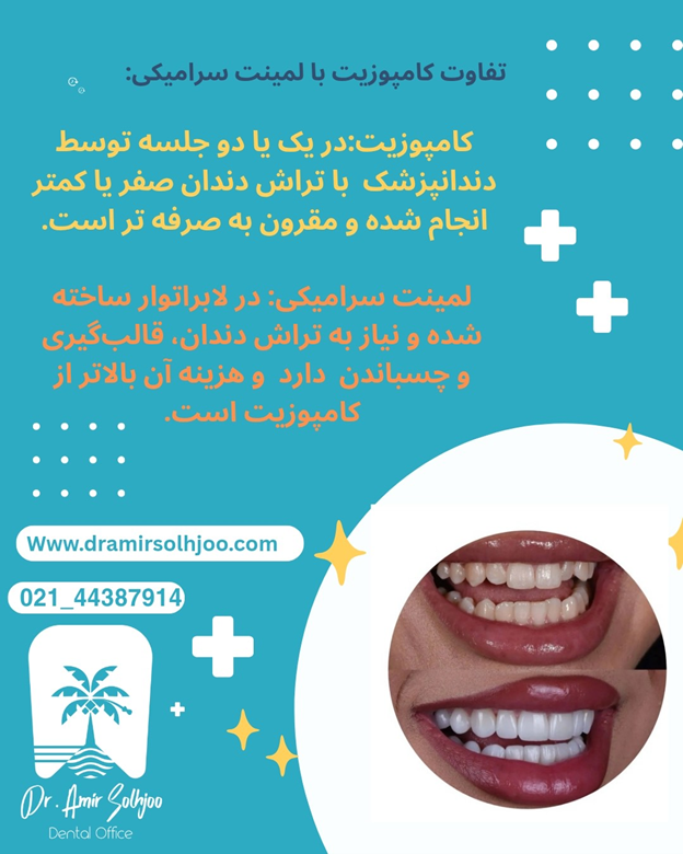 تفاوت کامپوزیت با لمینت سرامیکی