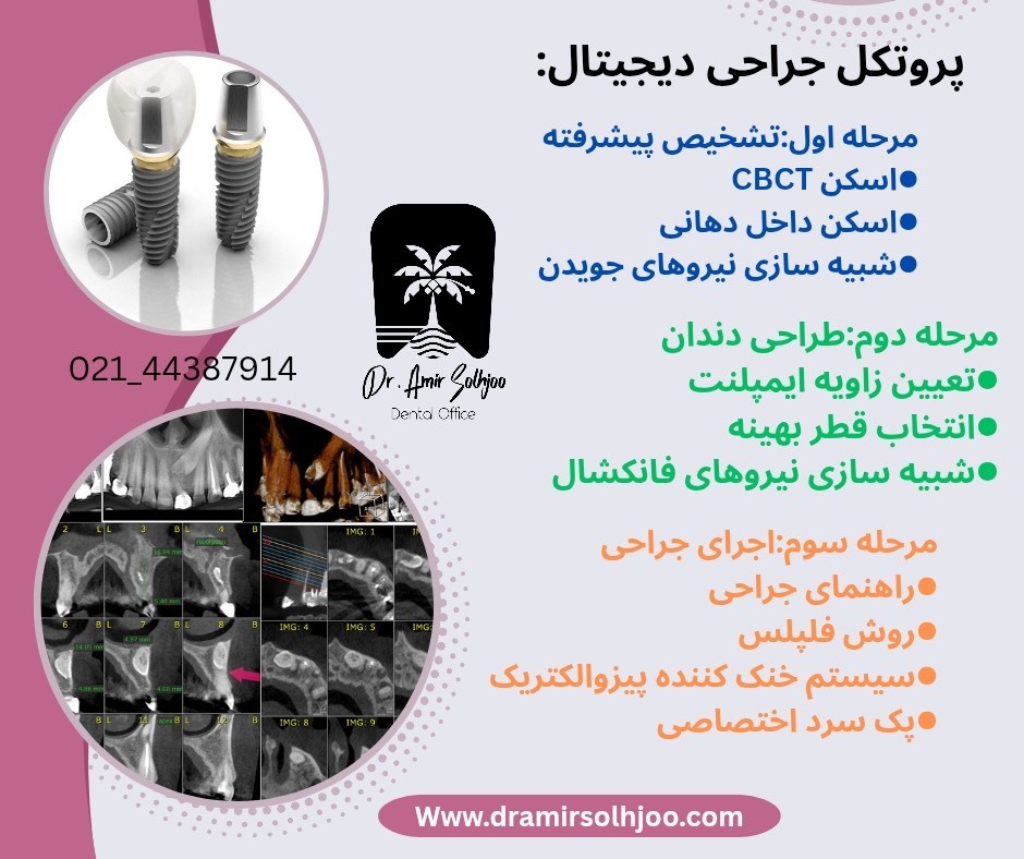 جراحی دیجیتال دندان