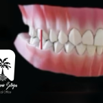 اکلوژن بالانس