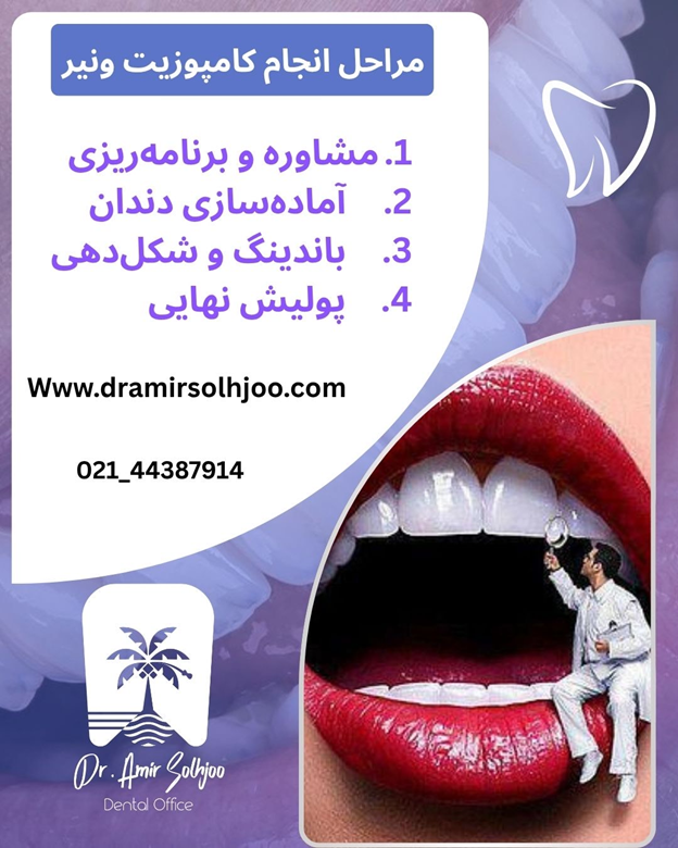 کامپوزیت دندان